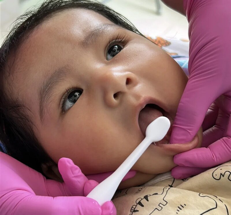Atención dental para bebés